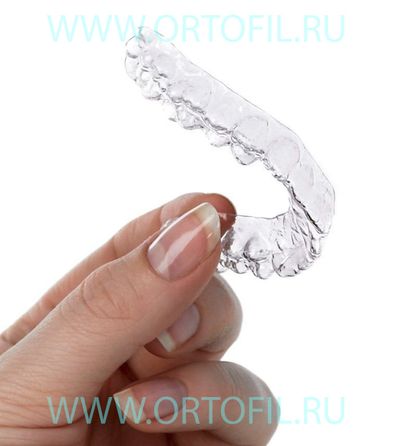 съемная каппа на зубы